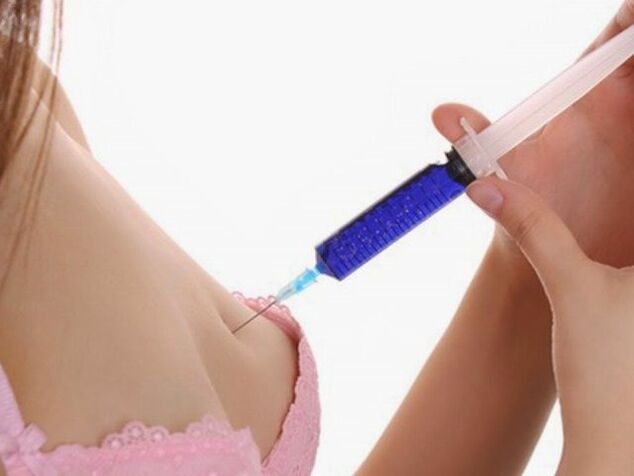 injekcie kyseliny hyalurónovej na zväčšenie prsníkov