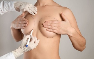 metódy zväčšenia prsníkov chirurgickým zákrokom