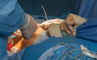 ako sa vykonáva operácia na zväčšenie prsníkov