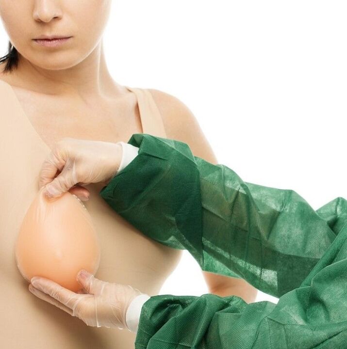 implantáty na zväčšenie prsníkov